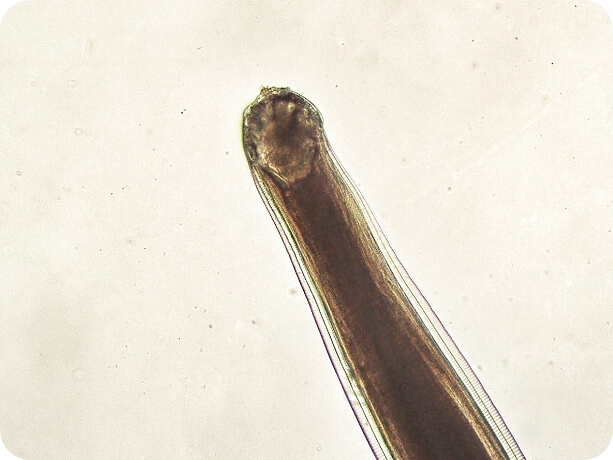 Image of a hookworm up close
