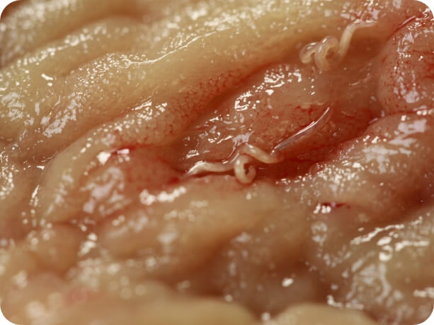 Image of hookworms in intestines