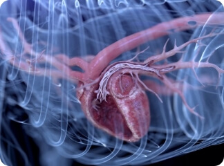 A graphic depicting a heartworm infection