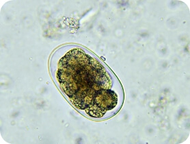 A microscopic view of hookworm eggs