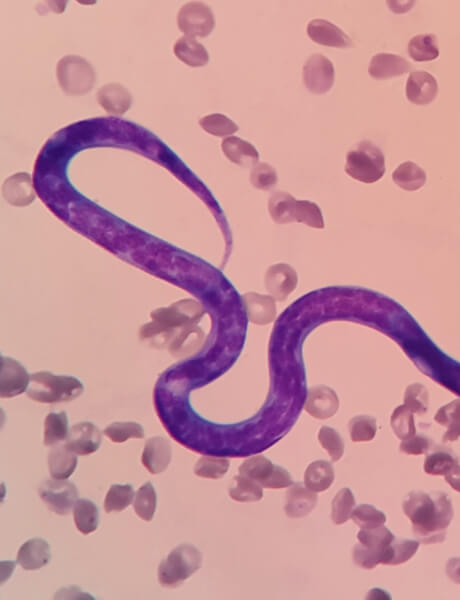 A microscopic view of a single heartworm