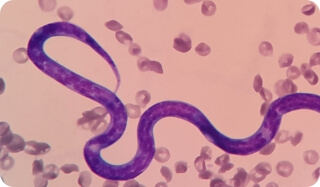 A microscopic view of a single heartworm
