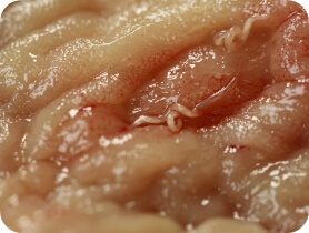 A view of adult hookworms inside organ tissue