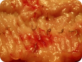 Hookworm larvae inside organ tissue