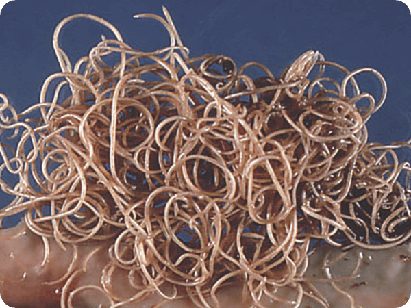 A tangle of roundworms